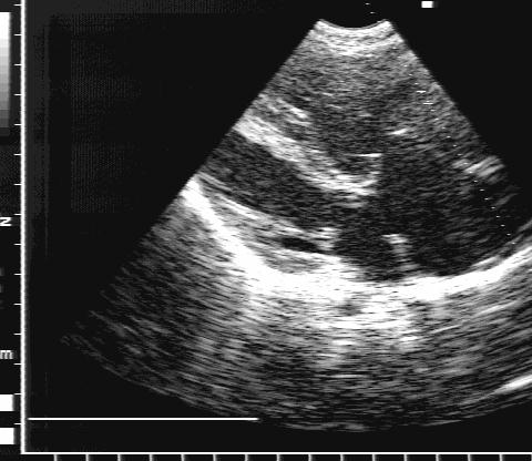 ��������-�������� ������������������� �����: ��������� ���� �
������������ �������� ���������� ������� � ���������� �����.