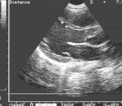 ��������� ������ ��������������� ����������� �� ���������� �����.