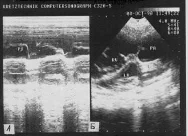 ��������������� ��� ��������� �������� �����������.