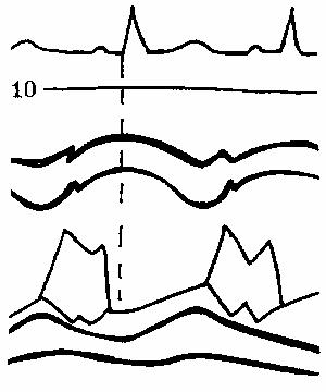 ��������������� �������� ����������� �������.