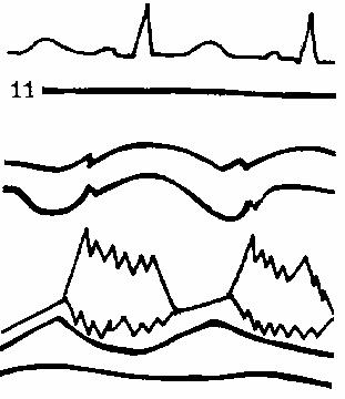 �������������� ���������� ������� ����������� �������.