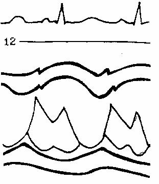 ������� ����������� �������.