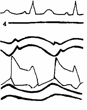 ���������� �������� �������� ����������� �������.