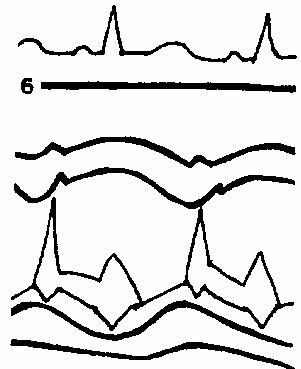 ���������� ������� EF �������� ���������� �������.