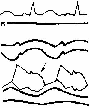 ���������� ������� AC �������� ���������� �������.