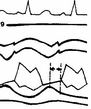 �������� �������� ����������� �������.