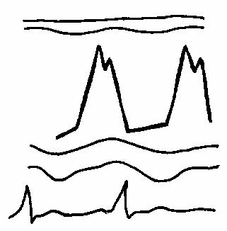 ���������� ��������� �������� �������
���������������� �������.