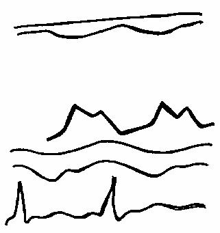 ���������� ��������� �������� �������
���������������� �������.