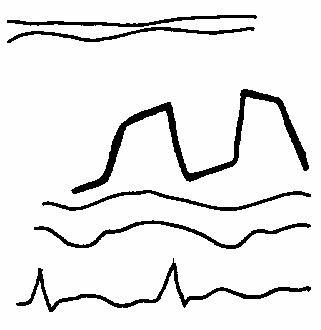 ���������� ������� EF �������� ��������������� �������.