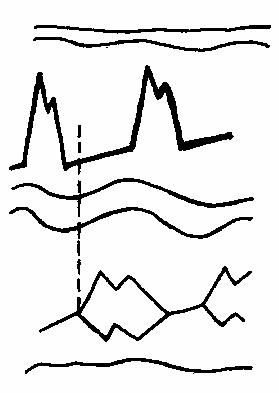 ��������������� �������� ���������������� �������.