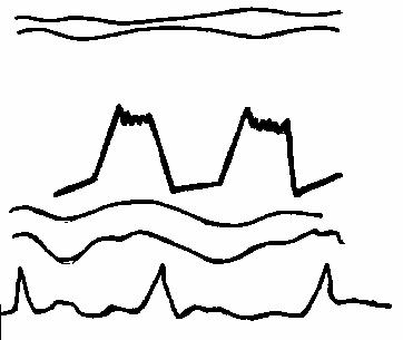 �������������� ���������� �������� ���������������
�������.