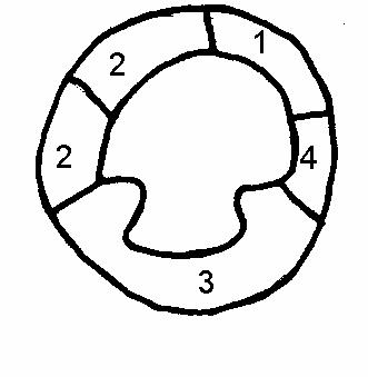 Парастернальная короткая ось на уровне папиллярных мышц.